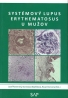 J. Rovenský a kol. - Systémový lupus erythematosus u mužov